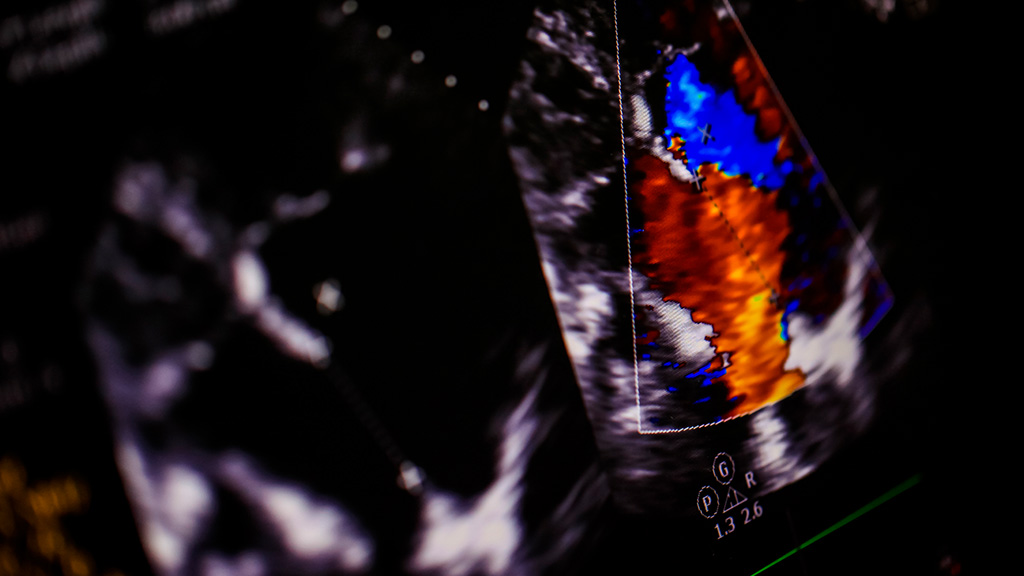 Ultrasonido Doppler Color Utero y Ov.(Suprapúbico)