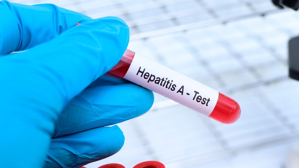 Ac. Anti - Hepatitis A (IgG)