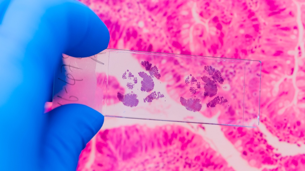 Ag. Carcinoembrionario (CEA)