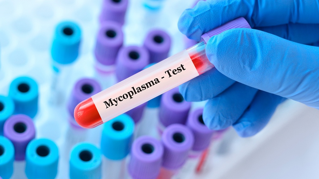 Cultivo de Mycoplasma