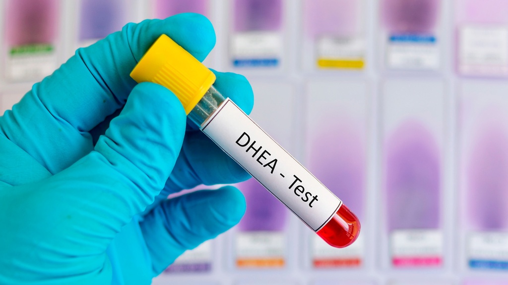 Dehidroepiandrosterona (DHEA)
