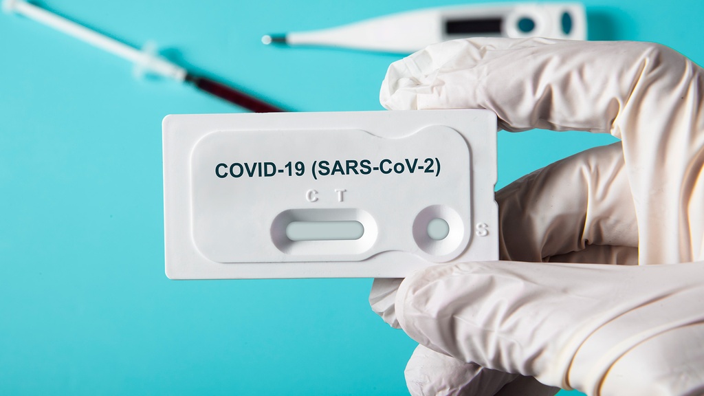 SARS-CoV-2 IgG (2a Generación)