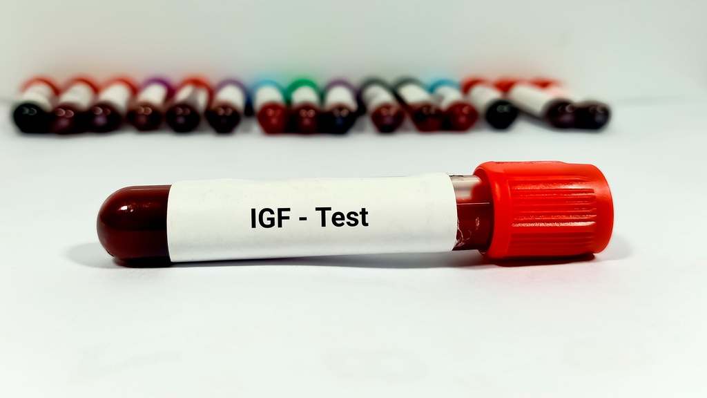Somatomedina - C (IGF-1)