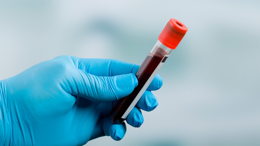 Electroforesis de Proteínas Séricas