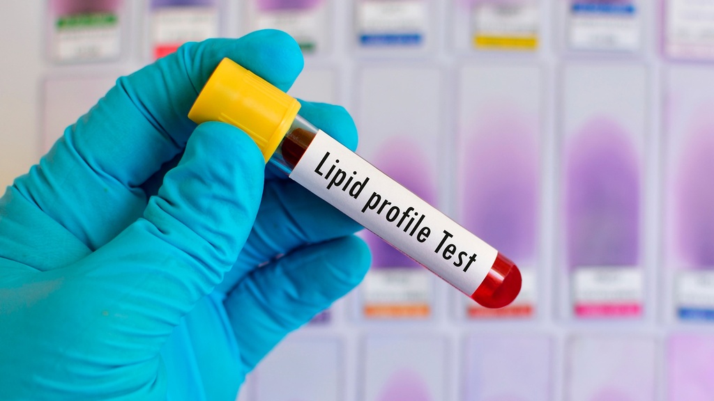 Lipoproteína VLDL