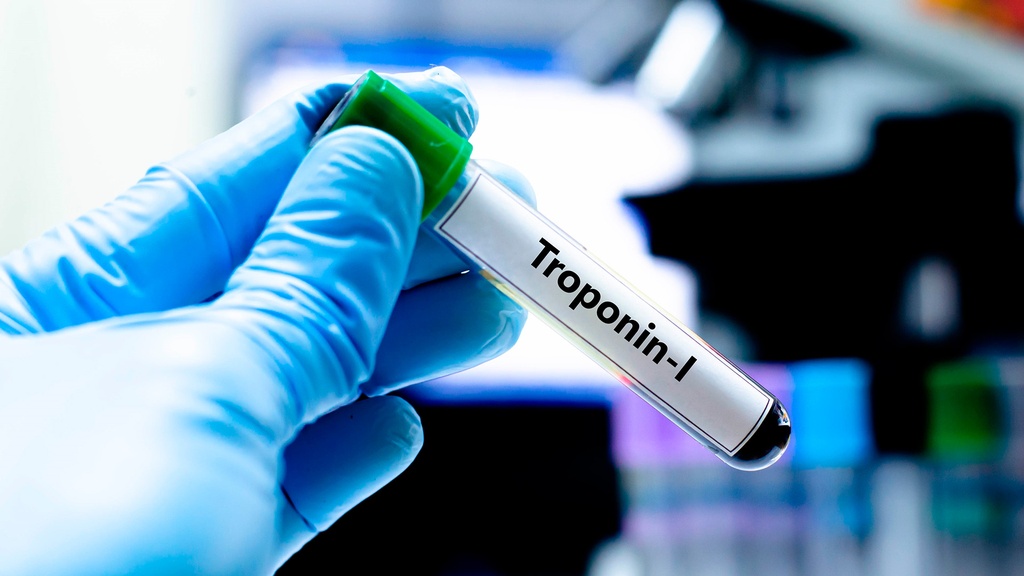 Troponina I