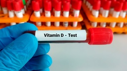 [25HIDR] 25 - Hidroxivitamina D (D3) Trece