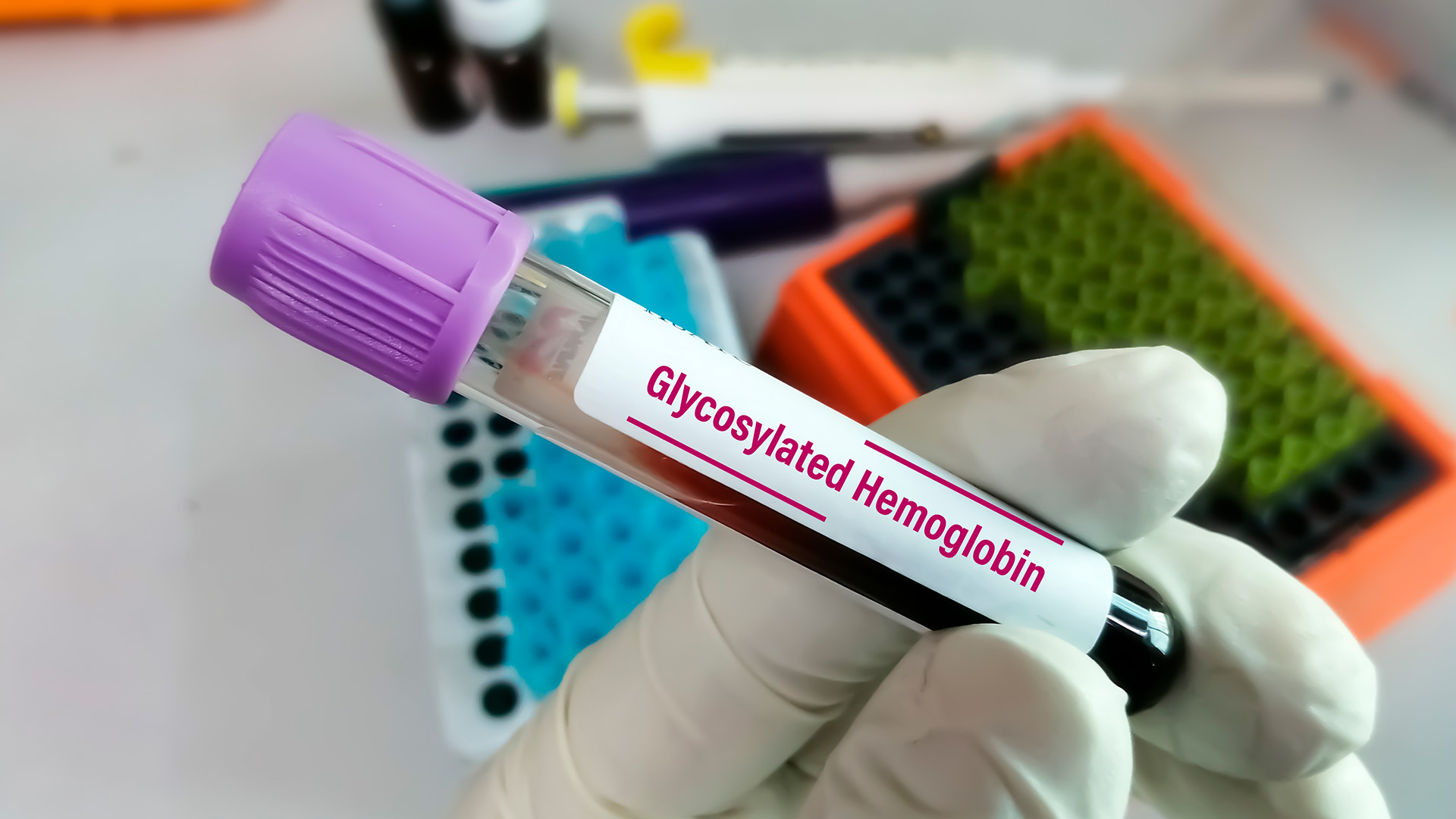 Hemoglobina Glucosilada (HB A1C) en sangre total Trece