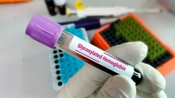 [HEMGLU] Hemoglobina Glucosilada (HB A1C) en sangre total Trece