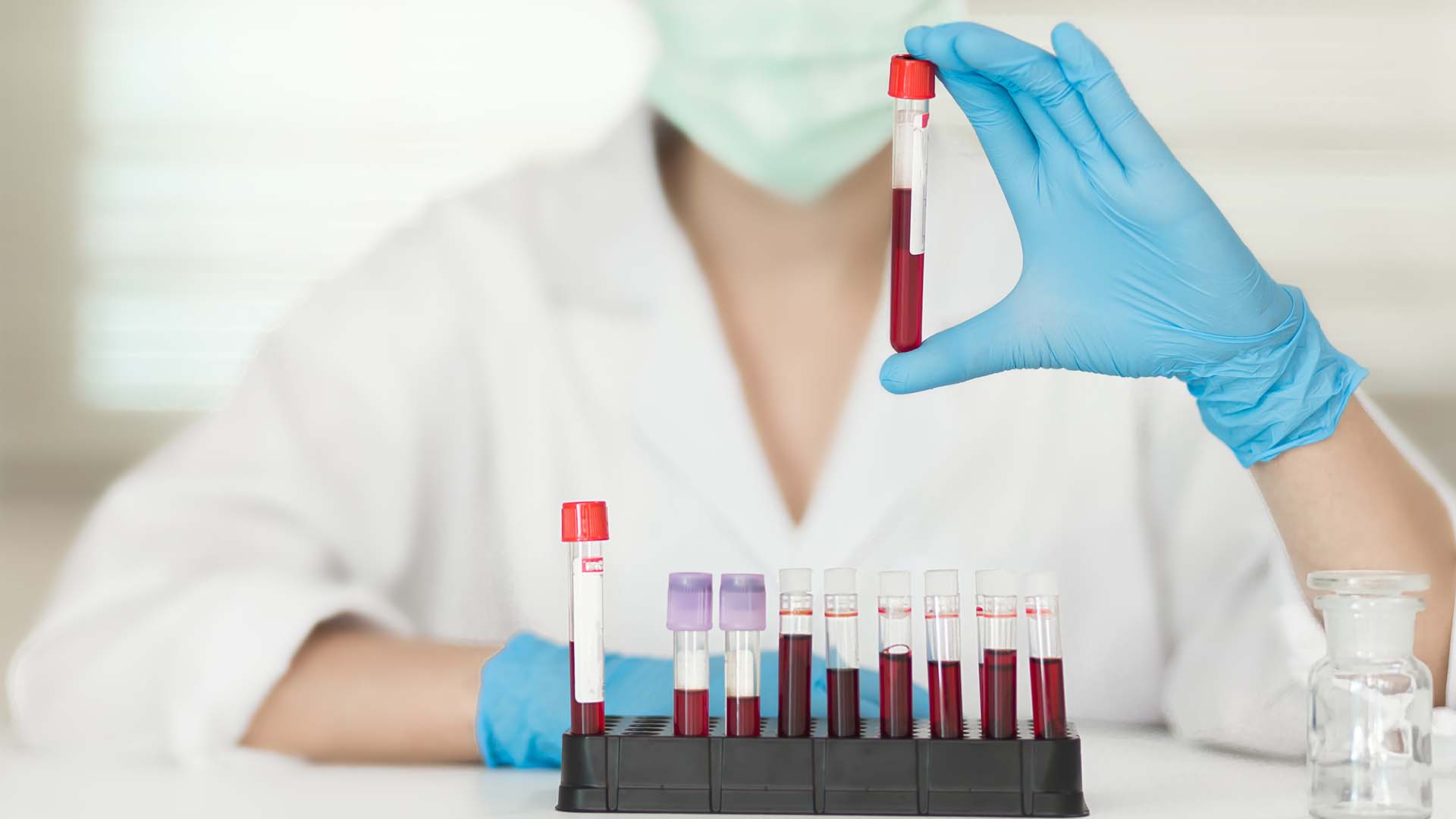 Química Sanguínea de 6 Elementos TRece