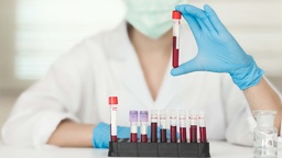 [QUISA6] Química Sanguínea de 6 Elementos TRece