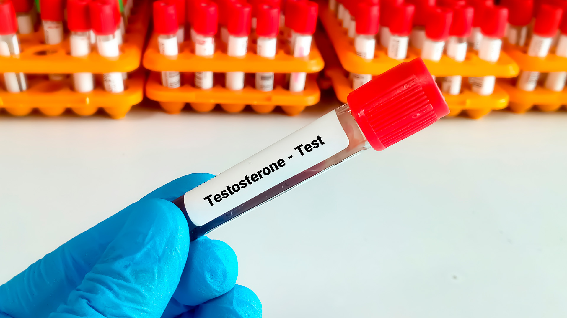 Testosterona Total